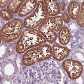 Anti-SLC27A2 antibody produced in rabbit Prestige Antibodies&#174; Powered by Atlas Antibodies, affinity isolated antibody, buffered aqueous glycerol solution