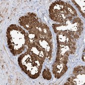 Anti-TGM4 antibody produced in rabbit Prestige Antibodies&#174; Powered by Atlas Antibodies, affinity isolated antibody, buffered aqueous glycerol solution