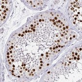 Monoclonal Anti-ANLN antibody produced in mouse Prestige Antibodies&#174; Powered by Atlas Antibodies, clone CL0301, purified immunoglobulin, buffered aqueous glycerol solution