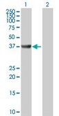 Anti-ADA antibody produced in rabbit purified immunoglobulin, buffered aqueous solution