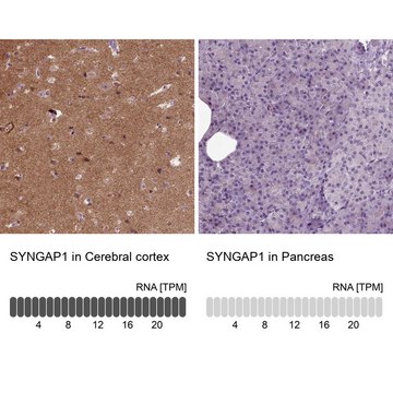 Anti-SYNGAP1 antibody produced in rabbit Prestige Antibodies&#174; Powered by Atlas Antibodies, affinity isolated antibody, buffered aqueous glycerol solution