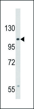ANTI-CACNA2D3 (C-TERM) antibody produced in rabbit IgG fraction of antiserum, buffered aqueous solution