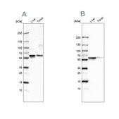 Anti-SERPINA1 antibody produced in rabbit Prestige Antibodies&#174; Powered by Atlas Antibodies, affinity isolated antibody, buffered aqueous glycerol solution