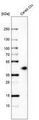 Monoclonal Anti-B3GAT1 antibody produced in mouse Prestige Antibodies&#174; Powered by Atlas Antibodies, clone CL9499, purified immunoglobulin, buffered aqueous glycerol solution