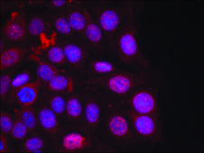 Anti-phospho-PGR (pSer190) antibody produced in rabbit affinity isolated antibody