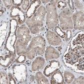 Anti-DST antibody produced in rabbit Prestige Antibodies&#174; Powered by Atlas Antibodies, affinity isolated antibody, buffered aqueous glycerol solution