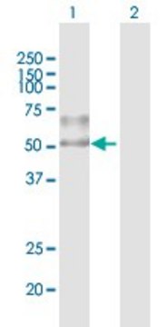 Anti-ENTPD1 antibody produced in mouse purified immunoglobulin, buffered aqueous solution