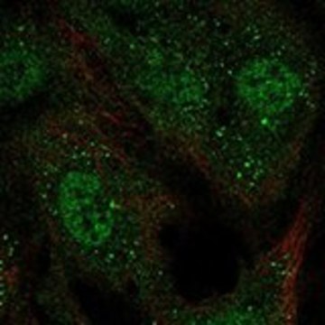 Anti-KCNAB1 antibody produced in rabbit Prestige Antibodies&#174; Powered by Atlas Antibodies, affinity isolated antibody, buffered aqueous glycerol solution