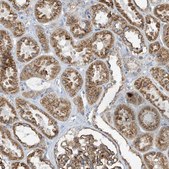 Anti-ITM2B antibody produced in rabbit Prestige Antibodies&#174; Powered by Atlas Antibodies, affinity isolated antibody, buffered aqueous glycerol solution