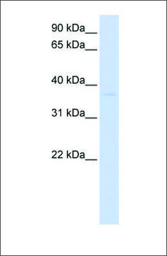 Anti-GDAP1L1 antibody produced in rabbit affinity isolated antibody