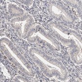 Anti-TNNI1 antibody produced in rabbit Prestige Antibodies&#174; Powered by Atlas Antibodies, affinity isolated antibody, buffered aqueous glycerol solution