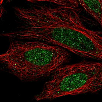 Anti-CCDC36 antibody produced in rabbit Prestige Antibodies&#174; Powered by Atlas Antibodies, affinity isolated antibody
