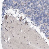 Anti-GABRG1 antibody produced in rabbit Prestige Antibodies&#174; Powered by Atlas Antibodies, affinity isolated antibody, buffered aqueous glycerol solution