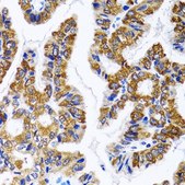 Anti-Fatty Acid Synthase antibody produced in rabbit