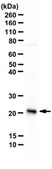 Anti-Recoverin Antibody from rabbit, purified by affinity chromatography