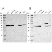Anti-SERPINB6 antibody produced in rabbit Ab1, Prestige Antibodies&#174; Powered by Atlas Antibodies, affinity isolated antibody, buffered aqueous glycerol solution