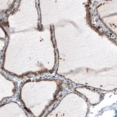 Monoclonal Anti-ITGB3 antibody produced in mouse Prestige Antibodies&#174; Powered by Atlas Antibodies, clone CL7319, purified immunoglobulin, buffered aqueous glycerol solution