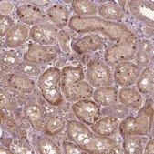Anti-PARP3 antibody produced in rabbit Prestige Antibodies&#174; Powered by Atlas Antibodies, affinity isolated antibody, buffered aqueous glycerol solution