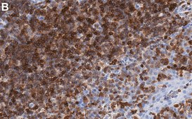 Anti-NFAT1 Antibody, clone 1D19 ZooMAb&#174; Rabbit Monoclonal recombinant, expressed in HEK 293 cells
