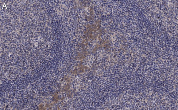 Anti-CCR2 Antibody, clone 5K5-3 ZooMAb&#174; Rabbit Monoclonal recombinant, expressed in HEK 293 cells