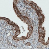 Monoclonal Anti-DIAPH2 antibody produced in mouse Prestige Antibodies&#174; Powered by Atlas Antibodies, clone CL1111, purified immunoglobulin, buffered aqueous glycerol solution