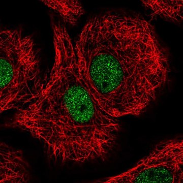 Anti-DDB1 antibody produced in rabbit Prestige Antibodies&#174; Powered by Atlas Antibodies, affinity isolated antibody