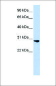 Anti-FGF2 antibody produced in rabbit affinity isolated antibody
