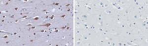 Anti-Renin Receptor Antibody, clone 1C22 ZooMAb&#174; Rabbit Monoclonal recombinant, expressed in HEK 293 cells