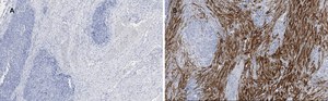 Anti-Calponin 1 Antibody, clone 9D14, ZooMAb&#174; Rabbit Monoclonal recombinant, expressed in HEK 293 cells