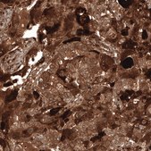 Anti-WFDC2 antibody produced in mouse Prestige Antibodies&#174; Powered by Atlas Antibodies, clone CL12886, purified by using Protein A, buffered aqueous glycerol solution