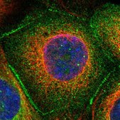 Anti-TP53BP2 antibody produced in rabbit Prestige Antibodies&#174; Powered by Atlas Antibodies, affinity isolated antibody, buffered aqueous glycerol solution