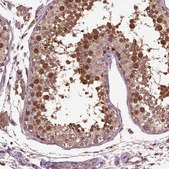 Anti-ERV3-1 Prestige Antibodies&#174; Powered by Atlas Antibodies, affinity isolated antibody