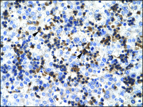 Anti-RUVBL2 antibody produced in rabbit affinity isolated antibody