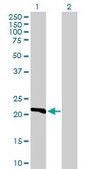 Anti-DHFR antibody produced in rabbit purified immunoglobulin, buffered aqueous solution