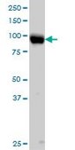 Monoclonal Anti-ITGB5 antibody produced in mouse clone 2C4, purified immunoglobulin, buffered aqueous solution