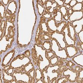 Anti-LALBA antibody produced in rabbit Prestige Antibodies&#174; Powered by Atlas Antibodies, affinity isolated antibody
