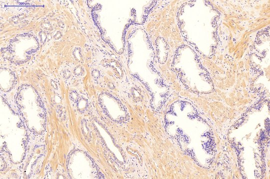 Anti-CDKN1A (N-terminal) antibody produced in rabbit affinity isolated antibody
