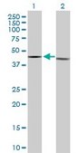 Anti-ESRRA antibody produced in rabbit purified immunoglobulin, buffered aqueous solution