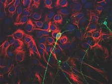 Anti-Beta III Tubulin Antibody Chemicon&#174;, from chicken