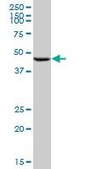 Anti-CHEK2 antibody produced in mouse purified immunoglobulin, buffered aqueous solution