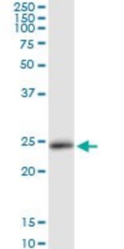 Anti-LCN2 antibody produced in rabbit purified immunoglobulin, buffered aqueous solution
