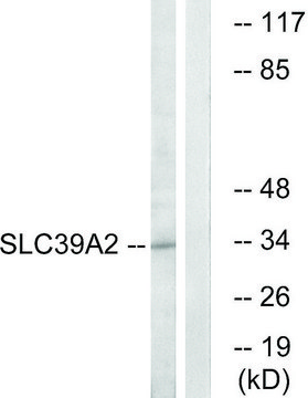 Anti-SLC39A2 antibody produced in rabbit affinity isolated antibody
