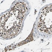 Anti-RHOT2 antibody produced in rabbit Prestige Antibodies&#174; Powered by Atlas Antibodies, affinity isolated antibody, buffered aqueous glycerol solution