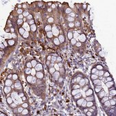 Anti-IRAK3 antibody produced in rabbit Prestige Antibodies&#174; Powered by Atlas Antibodies, affinity isolated antibody, buffered aqueous glycerol solution
