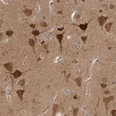 Anti-PRKAR1B antibody produced in rabbit Prestige Antibodies&#174; Powered by Atlas Antibodies, affinity isolated antibody, buffered aqueous glycerol solution