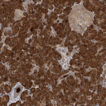 Anti-KIAA0556 antibody produced in rabbit Prestige Antibodies&#174; Powered by Atlas Antibodies, affinity isolated antibody, buffered aqueous glycerol solution