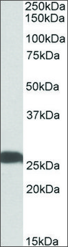 Anti-UCHL1 antibody produced in goat affinity isolated antibody, buffered aqueous solution