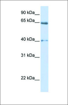 Anti-CACNB2 (ab1) antibody produced in rabbit affinity isolated antibody