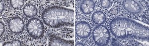 Anti-PML Antibody, clone 1F13 ZooMAb&#174; Rabbit Monoclonal recombinant, expressed in HEK 293 cells