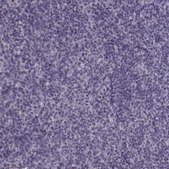 Anti-TRPM1 antibody produced in rabbit Prestige Antibodies&#174; Powered by Atlas Antibodies, affinity isolated antibody